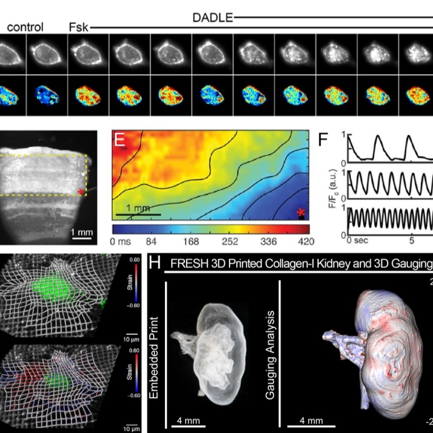 Biosensor Development