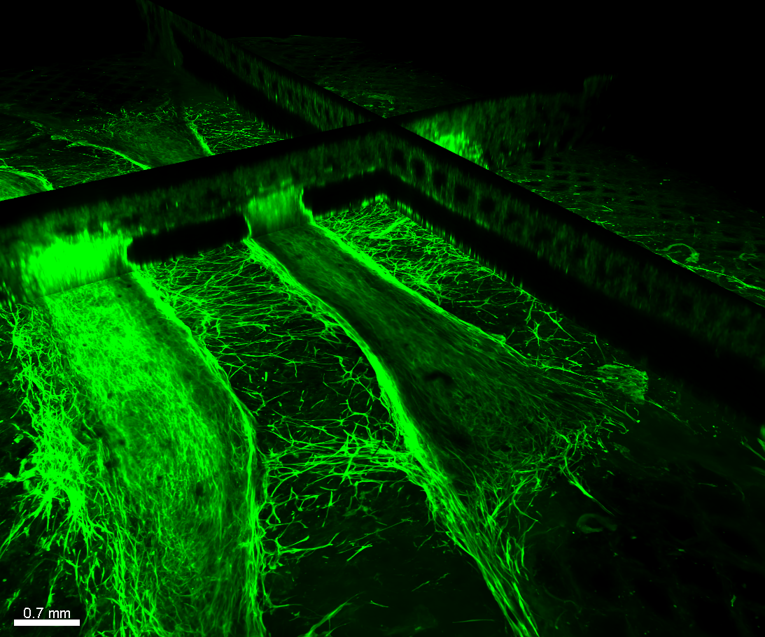 Vascular Disease Models Vascular Disease Models