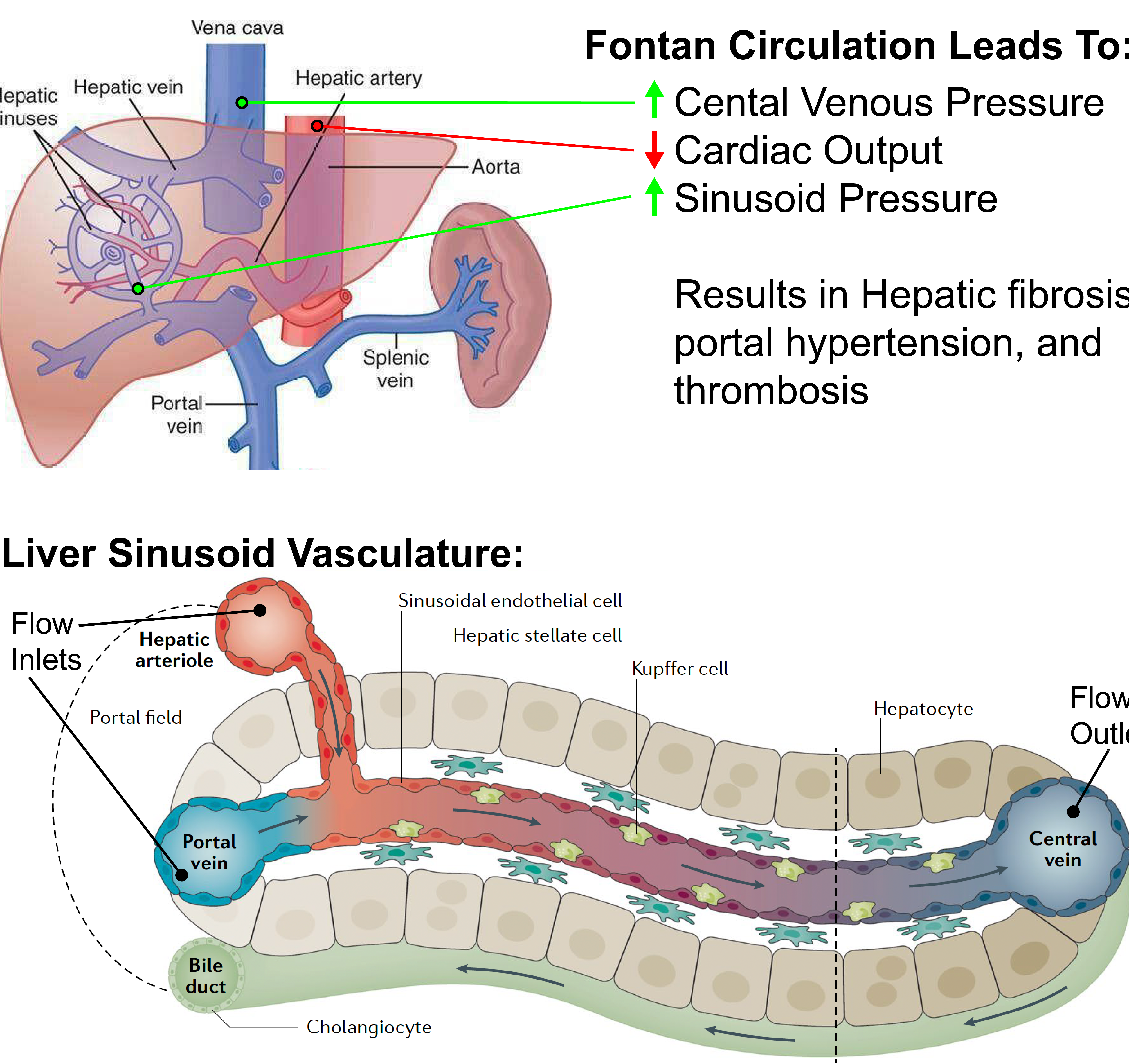 Hepatic Thrombosis