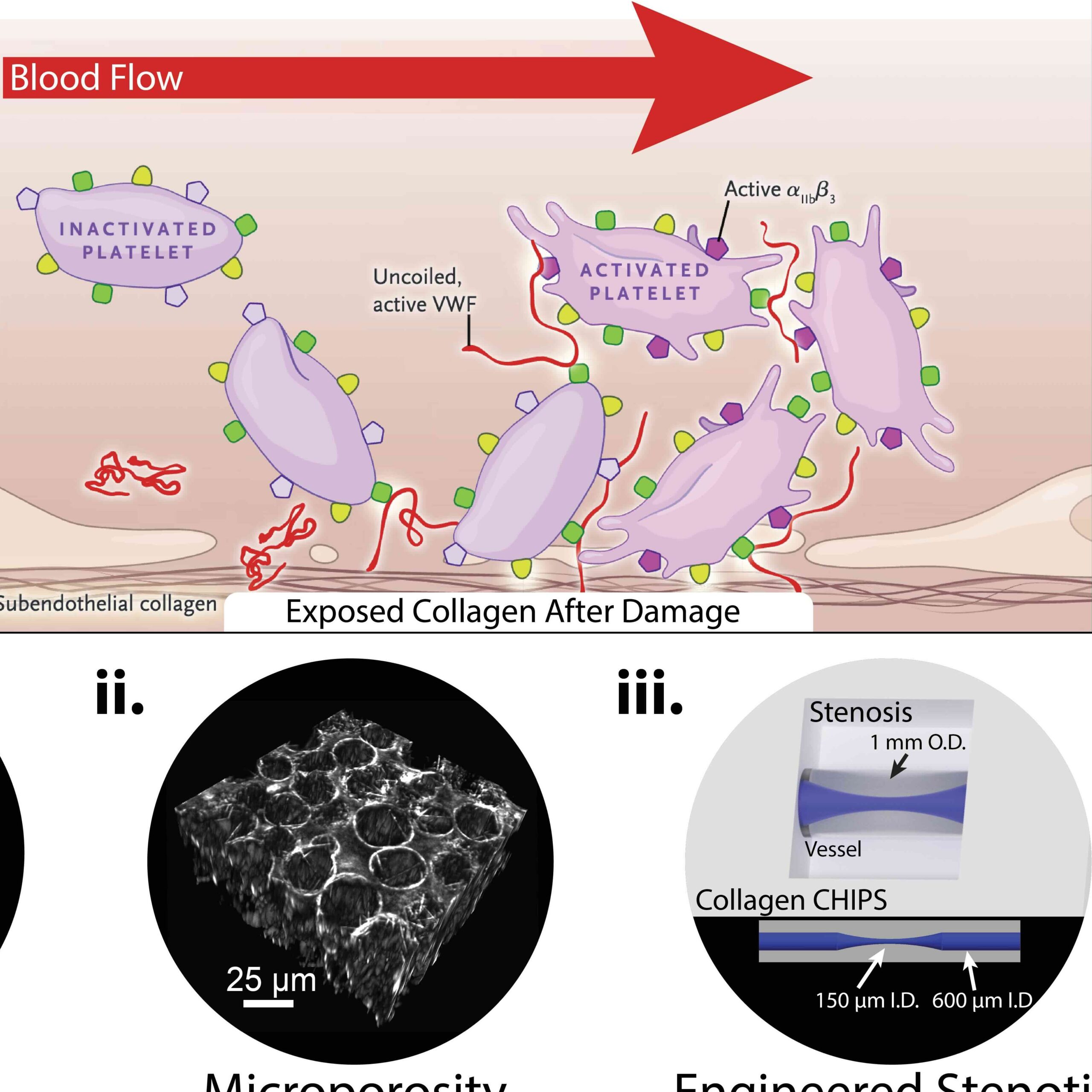 Studying VWF Disorders