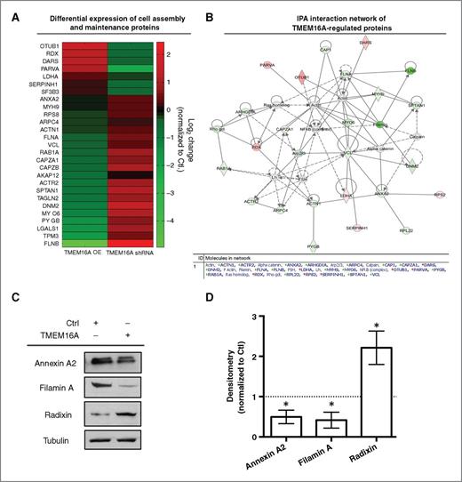 TMEM16A Expression as a Switch between Tumor Growth and Metastasis in SCCHN